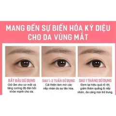 KEM GIẢM THÂM MẮT BỌNG MẮT COLLAGEN PLUS VIT E 701 CHÍNH HÃNG - GDN