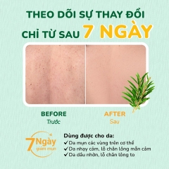 SỮA TẮM TRÀM TRÀ GIẢM MỤN LƯNG VÀ BODY NEOACNES 250ML - NEO ACNES