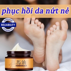 KEM DẦU NGỰA TRỊ NẺ, KHÔ DA, NỨT GÓT CHÂN
