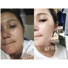 KEM 4K BERRY PLUS MẪU MỚI NHẤT CHÍNH HÃNG - GDN