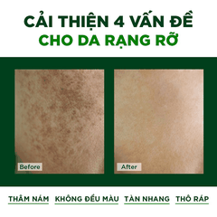 VIÊN SERUM GIÚP DƯỠNG DA, LÀM MỜ VẾT THÂM NÁM ORIBE 36 VIÊN