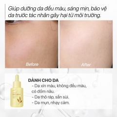 SERUM DƯỠNG TRẮNG MỜ THÂM NÁM, CĂNG BÓNG NGỪA MỤN - GUO