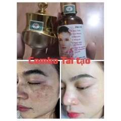 COMBO KEM TRỊ NÁM , KEM DƯỠNG HỔ TRỢ TÁI TẠO DA ĐỐM NÂU, ĐỒI MỒI GIA TRUYỀN - GDN