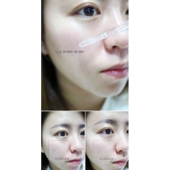TINH CHẤT CẤP NƯỚC, LÀM DỊU DA AHC PREMIUM EX HYDRA B5 SOOTHER 30ML - GDN
