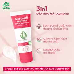 KEM GIẢM MỤN ĐẦU ĐEN, MỤN CÁM ACNEVIR SANTAFA THÀNH PHẦN THIÊN NHIÊN TUÝP 10GR - SANTAFA