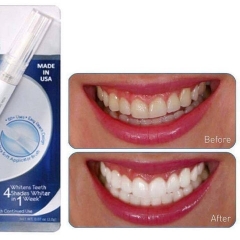 BÚT TẨY TRẮNG RĂNG SIÊU TỐC