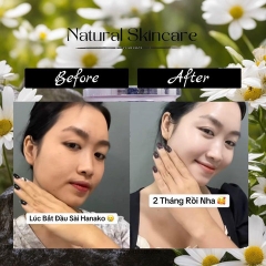 KEM FACE HANAKO X3 NHẬT BẢN CHÍNH HÃNG DƯỠNG TRẮNG ĐẸP DA 12G - GDN
