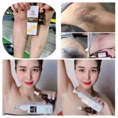KEM TẨY LÔNG HUYỀN PHI TẶNG KÈM SERUM ỨC CHẾ MỌC LÔNG 120ML - SU