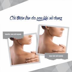 GEL LÀM MỜ SẸO SCAR GEL -FIXDERMA DO MỤN, BỎNG, RẠN DA, VẾT THƯƠNG (TUÝP 15ML)