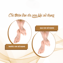 KEM MỀM GÓT CHÂN FOOT CREAM - FIXDERMA TUÝP 60 G