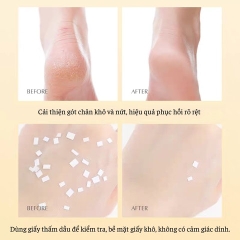 GEL BÔI NỨT GÓT CHÂN HEYXI 30GR - GDN