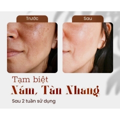 KEM SILEX NGÀY & ĐÊM THÂM NÁM SẠM TÀN NHANG LÀM TRẮNG DA MỜ NẾP NHĂN - GDN