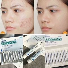 KEM TRỊ MỤN NHẬT BẢN DALACIN T GEL 1% - HGS