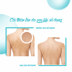 KEM DƯỠNG ẨM GIÚP DA MỀM MẠI MOISTURIZING CREAM - FIXDERMA TUÝP 60G