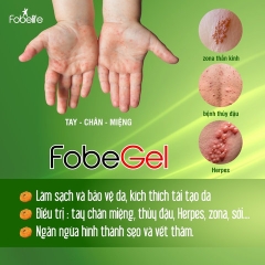 GEL BÔI TÁI TẠO DA, THỦY ĐẬU, ZONA DO VIRUS GÂY NÊN FOBE GEL ANTI VIRUS 15G - FOBELIFE