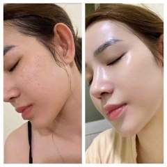 SERUM MEIDUZI PLUS DƯỠNG DA CĂNG BÓNG, SÁNG HỒNG TỰ NHIÊN - GDN