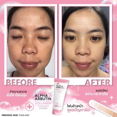 SỮA RỬA MẶT TRẮNG DA NGĂN NGỪA MỤN ALPHA ARBUTIN LOLLAGEN FOAMING CLEANSER THÁI LAN 120ML - GDN