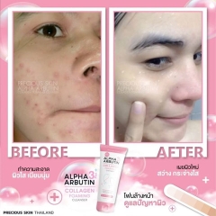 SỮA RỬA MẶT TRẮNG DA NGĂN NGỪA MỤN ALPHA ARBUTIN LOLLAGEN FOAMING CLEANSER THÁI LAN 120ML - GDN