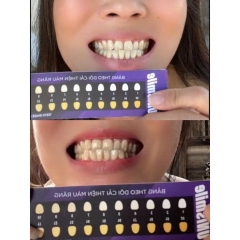 SERUM TRẮNG RĂNG UNLSMLLE, CHĂM SÓC HỔ TRỢ CẢI THIỆN VẾT Ố VÀNG NÂNG TÔNG RĂNG 10ML - GDN