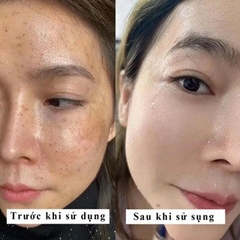 [COMBO 2SP] COMBO SERUM + KEM DƯỠNG SKINHDOR CHIẾT XUẤT TỪ THIÊN NHIÊN MỜ NÁM, SÁNG DA, CẤP ẨM, PHỤC HỒI LÀN DA