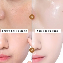 [HỘP 1 LỌ] SERUM 8 LỚP DƯỠNG ẨM PHỤC HỒI SÁNG DA TERISA SAKURA