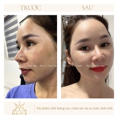 KEM NGÀY WHITENING DAY CREAM - MAIRIS