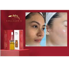 [HỘP] TINH CHẤT COLLAGEN-S LUXURY TRẺ HÓA, PHỤC HỒI DA VÀ DƯỠNG MÔI SAU PHUN XĂM - VIESKIN COLLAGEN - 3 LỌ/HỘP 910.525đ