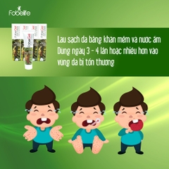 GEL BÔI TÁI TẠO DA, THỦY ĐẬU, ZONA DO VIRUS GÂY NÊN FOBE GEL ANTI VIRUS 15G - FOBELIFE