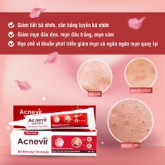 KEM TRỊ MỤN ĐẦU ĐEN, MỤN CÁM ACNEVIR (ĐỎ) - SANTAFA