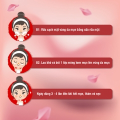 KEM TRỊ MỤN ĐẦU ĐEN, MỤN CÁM ACNEVIR (ĐỎ) - SANTAFA