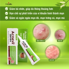 KEM TRỊ MỤN BỌC, MỤN MỦ ACNEVIR (XANH) - SANTAFA