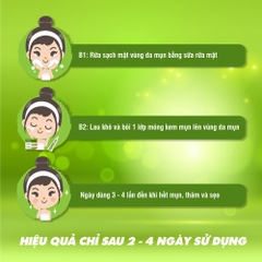 KEM TRỊ MỤN BỌC, MỤN MỦ ACNEVIR (XANH) - SANTAFA