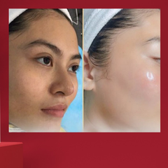 [HỘP] TINH CHẤT COLLAGEN-S GOLD SHINE CHỐNG LÃO HÓA, MỊN DA, CẤP ẨM - VIESKIN COLLAGEN - 3 LỌ/HỘP