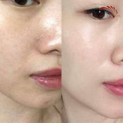 [HỘP] TINH CHẤT COLLAGEN-S GOLD SHINE CHỐNG LÃO HÓA, MỊN DA, CẤP ẨM - VIESKIN COLLAGEN - 3 LỌ/HỘP