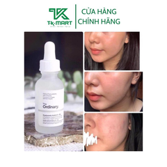 SERUM PHỤC HỒI DA HYALURONIC ACID 2% + B5 - THE ORDINARY
