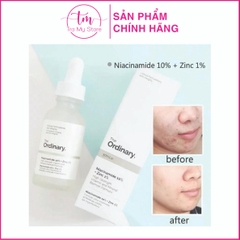 TINH CHẤT TRỊ MỤN, GIẢM THÂM NIACINAMIDE 10 + ZINC 1 - THE ORDINARY