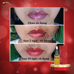 TINH CHẤT VIESKIN COLLAGEN -S LUXURY DƯỠNG KÍCH MÀU MÔI SAU PHUN XĂM VÀ TRẺ HÓA CĂNG BÓNG, PHỤC HỒI DA CHUYÊN SÂU