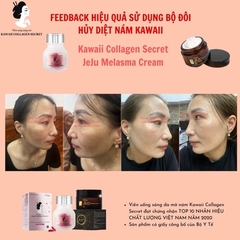 VIÊN UỐNG SÁNG DA COLLAGEN TẶNG KEM DƯỠNG DA 30G - KAWAII