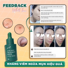 SERUM CHẤM MỤN, GOM KHÔ CỒI, GIẢM MỤN, MỜ THÂM - 100% FEEDBACK KHÁCH HÀNG TIN DÙNG HIỆU QUẢ - GUO
