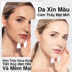 COMBO 10 MIẾNG MẶT NẠ HOA QUẢ DƯỠNG ẨM SE KHÍT LỖ CHÂN LÔNG 25G - GDN