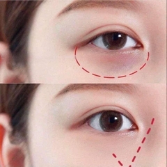 KEM DƯỠNG MẮT SỐ 1 THẾ GIỚI ADVANCED NIGHT REPAIR EYE - ESTEE LAUDER