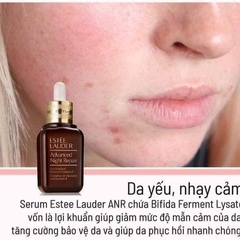 SERUM CHỐNG LÃO HÓA PHỤC HỒI DA SỐ 1 THẾ GIỚI ADVANCED NIGHT REPAIR - ESTEE LAUDER
