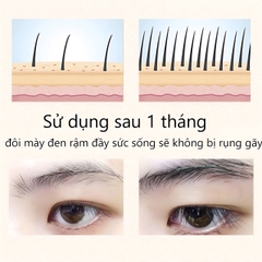 DƯỠNG MÀY FKN - MỌC LÔNG MÀY DÀI, DÀY, CHẮC KHỎE CỰC HIỆU QUẢ - MỸ PHẨM 24H