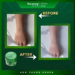 COMBO 5 KEM BODY LỤC TẢO LEGEND - SOO YOUNG