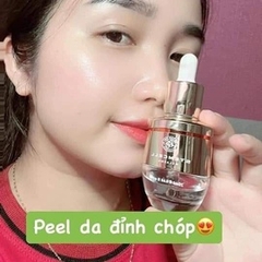 PELL DA NHÂN SÂM BÓC TÁCH - HUYỀN PHI STEMCELL MELASMA TẨY TẾ BÀO CHẾT
