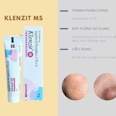 KEM TRỊ MỤN KLENZIT ẤN ĐỘ - GLENMARK