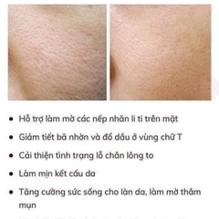 SERUM SE KHÍT LỖ CHÂN LÔNG, DƯỠNG TRẮNG DA NIACINAMIDE - BALEA