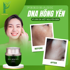 [TẶNG KÈM 1 KEM CHỐNG NẮNG SINH HỌC NINE'S BEAUTY] KEM DƯỠNG DA DNA HỒNG YẾN - PHỤC HỒI, CẤP ẨM, TRẮNG HỒNG & MỊN MÀNG - PHAN AN GREEN