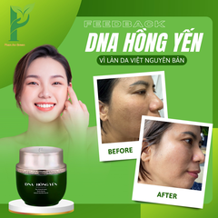 [TẶNG KÈM 1 KEM CHỐNG NẮNG SINH HỌC NINE'S BEAUTY] KEM DƯỠNG DA DNA HỒNG YẾN - PHỤC HỒI, CẤP ẨM, TRẮNG HỒNG & MỊN MÀNG - PHAN AN GREEN