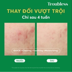 NƯỚC CÂN BẰNG TROUBLESS LÀM DỊU DA TẨY TẾ BÀO CHẾT, SÁNG DA, GIẢM MỤN 200ML